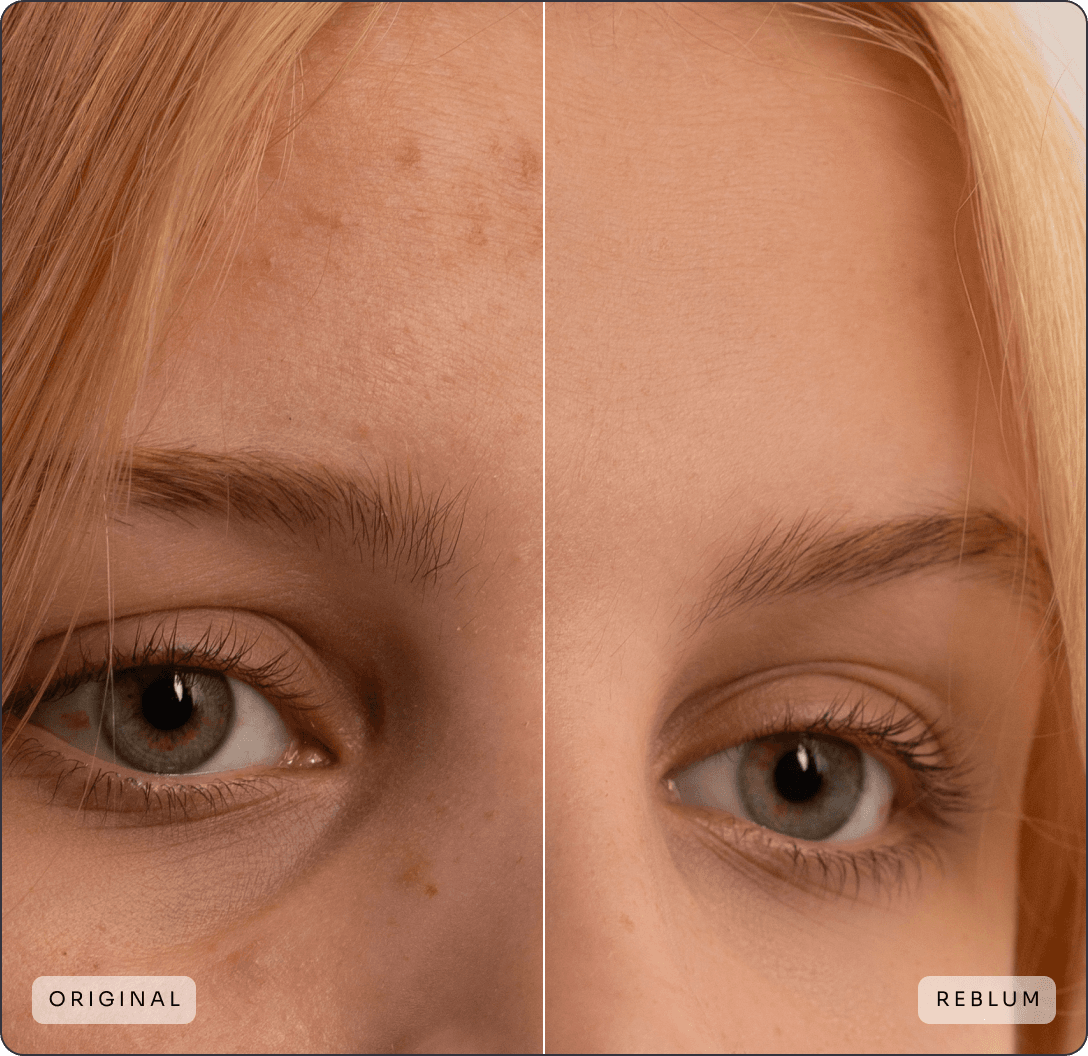 Images quality comparison